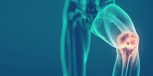 Você sabia que a artroplastia  de joelho foi realizada pela primeira vez em 1968?