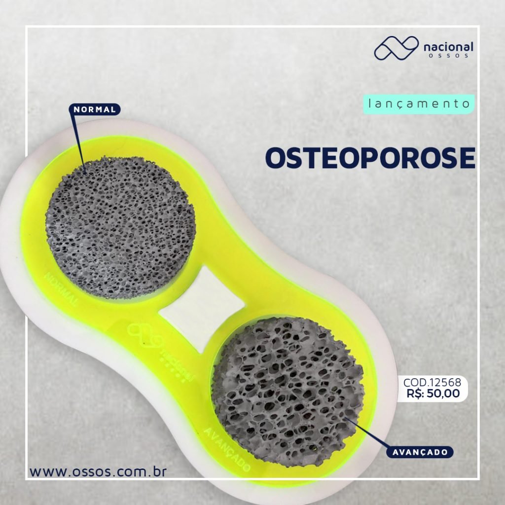 Modelo de osso artificial para demonstração de osteoporose