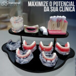 beneficios de explicar a implantodontia 